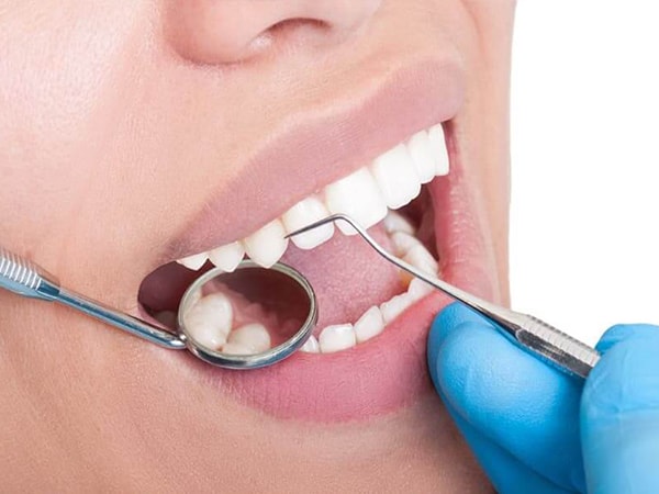 Biến chứng tiểu đường ở răng