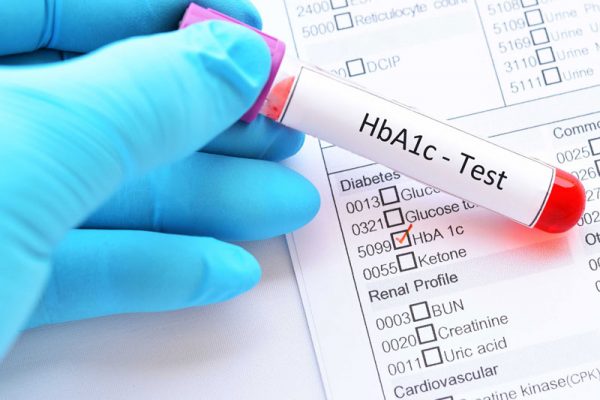 Xét nghiệm HbA1c là gì