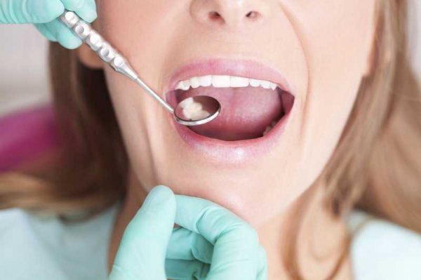 Phòng ngừa bệnh răng miệng ở người tiểu đường