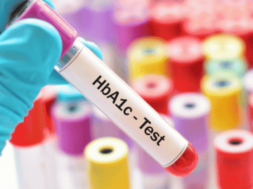 Ý nghĩa của việc xét nghiệm chỉ số HbA1c